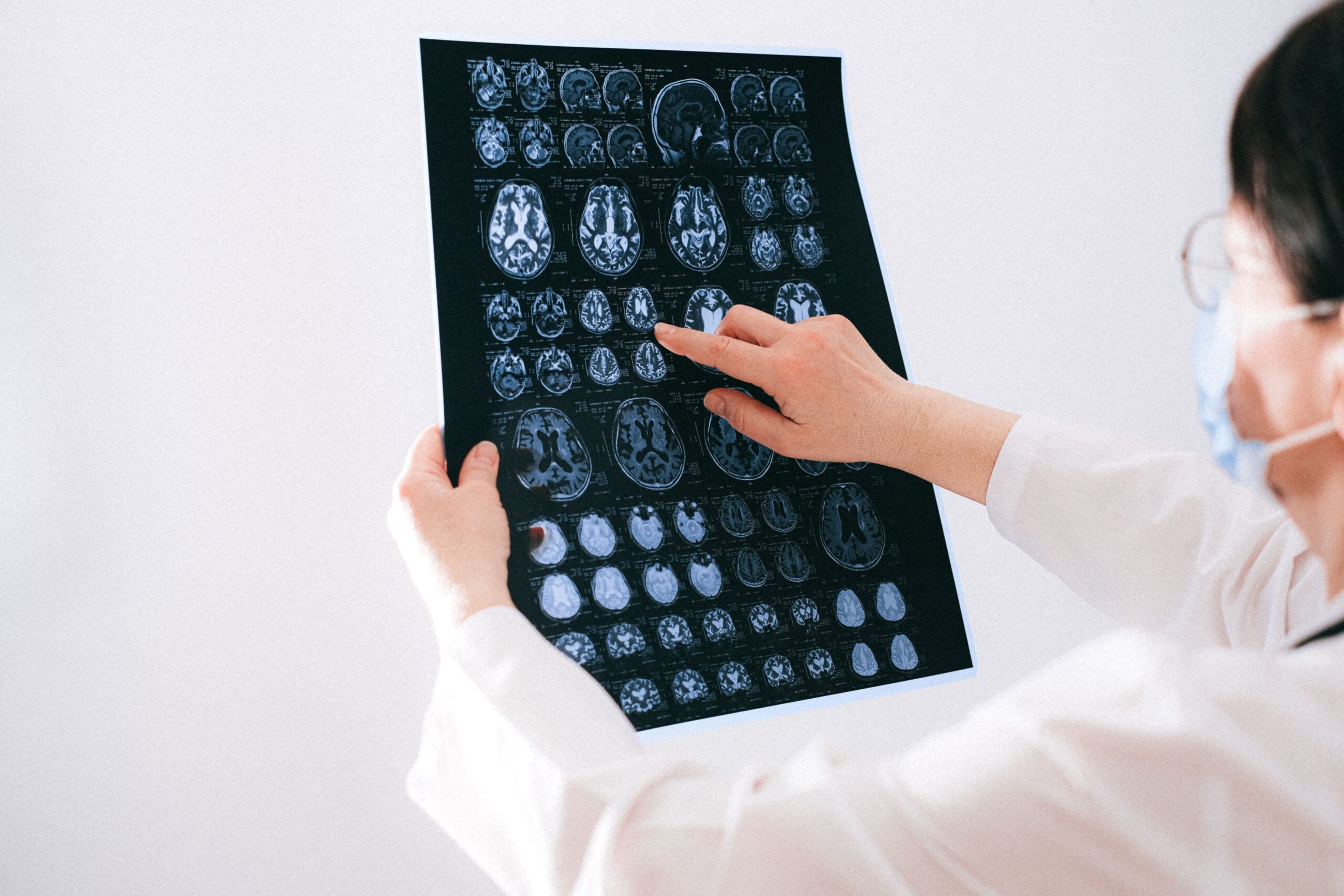 의사가 뇌 MRI 스캔 영상을 살펴보는 모습