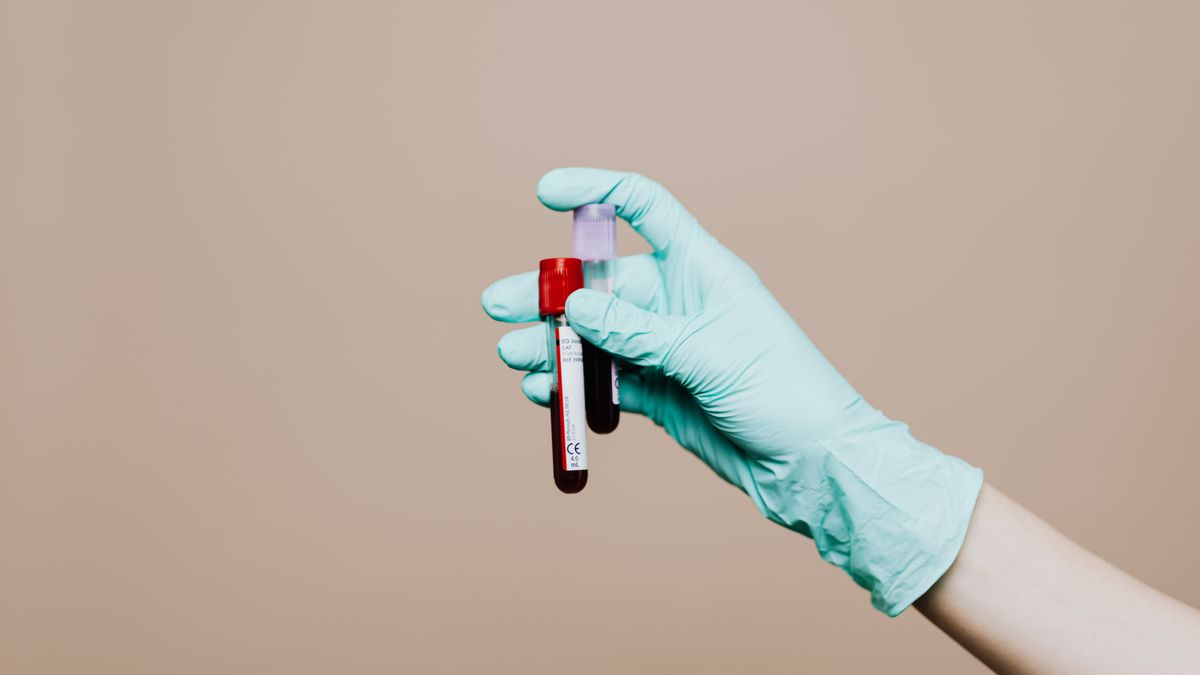 Blood sample tube used to measure LDL cholesterol and triglycerides