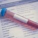 LDL cholesterol goals blood test tube on a lipid panel report LDL 콜레스테롤 수치