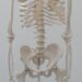 osteoporosis treatment bone and spine model 골다공증 치료제