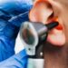 tinnitus treatment ear examination with an otoscope 이명 치료